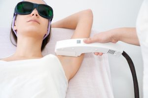 removing hair with laser. shutterstock